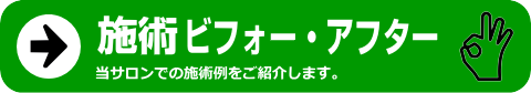 施術ビフォー・アフター